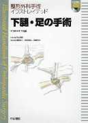 12)整形外科手術イラストレイテッド　下腿・足の手術